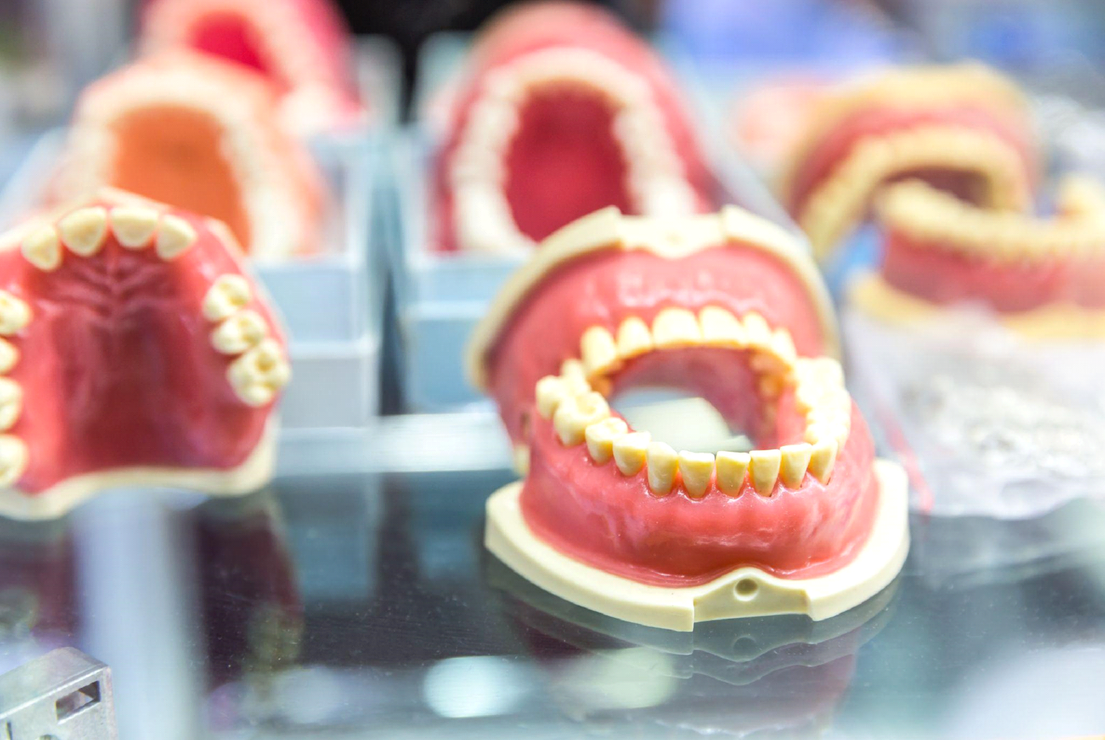 Jakie są rodzaje protez zębowych i którą z nich wybrać ?